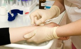 Проба Манту: коли вона потрібна?